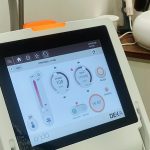 Korean ONDA Microwave Treatment Review: My Double Chin Is Gone, But Here’s What I Regret Not Asking First